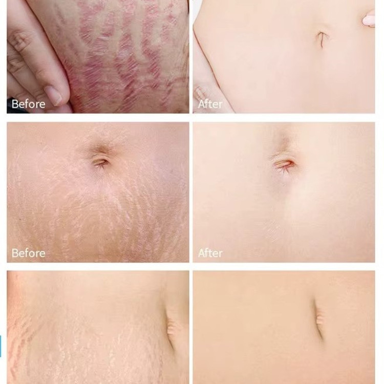روغن ترمیم کننده پوست نچرال بایو اویل مدل Natural (60 میل)